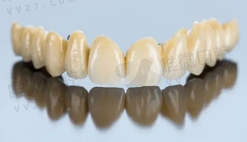 三、后牙做牙冠选择什么材料好？