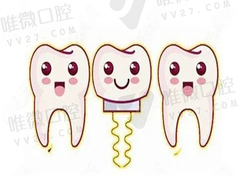 韩国种植牙多少钱一颗2023年