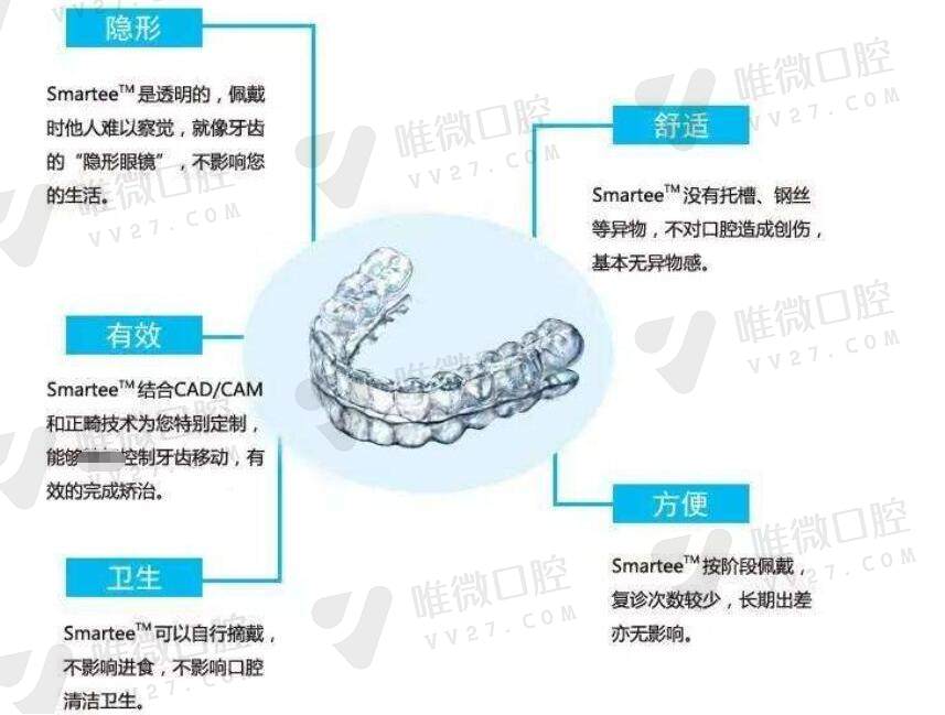 时代天使comfos青春版价格是多少