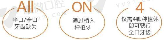种植牙allon4和allon6哪种更好