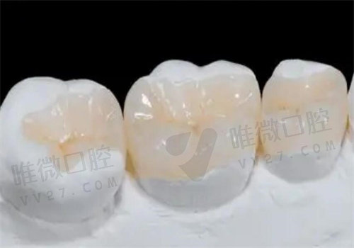 四川省人民医院口腔科补牙收费标准