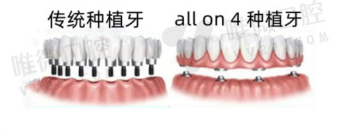 南京美奥口腔医院马院长种植牙怎么样
