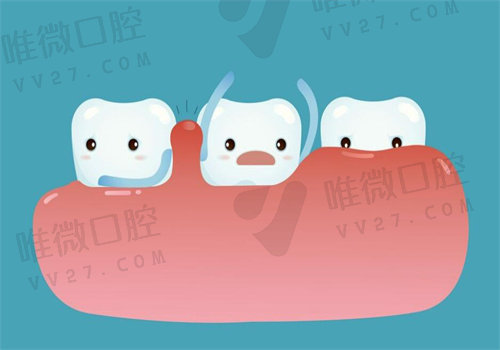 牙龈再生术是什么？