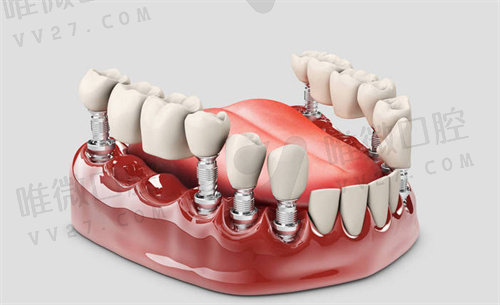 牙龈萎缩和牙槽骨吸收的原因