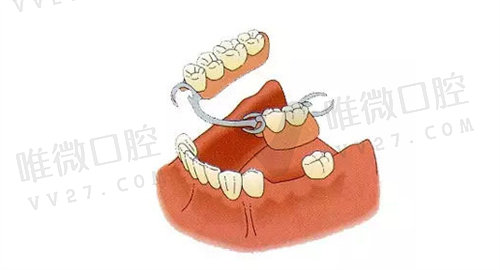 怎样预防牙龈萎缩和牙槽骨吸收