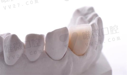 钛合金牙齿和氧化锆牙齿哪个好