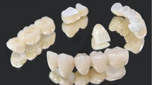 3d打印假牙和传统假牙有什么优缺点