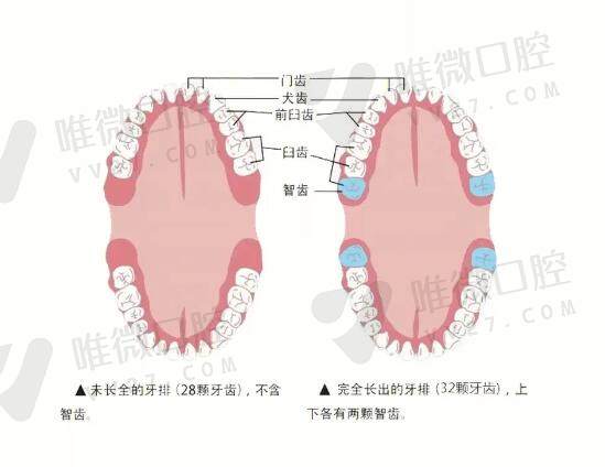 拔除智齿的注意事项