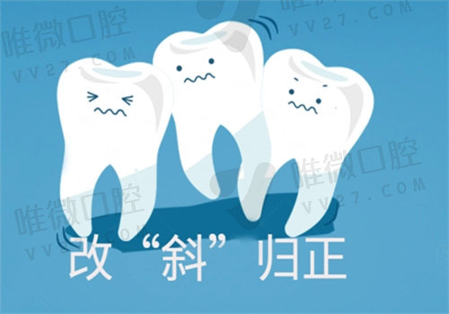 骨性反倾可以通过牙套矫正