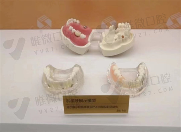南京市口腔医院牙齿矫正哪个医生好