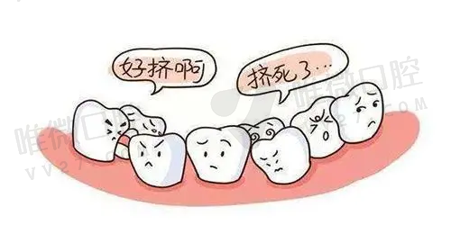 穿颧穿翼种植牙是什么