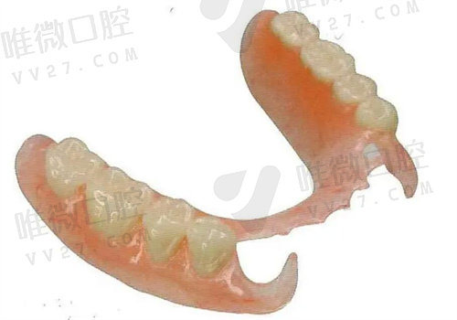 北京中诺口腔医院BPS吸附性义齿优势