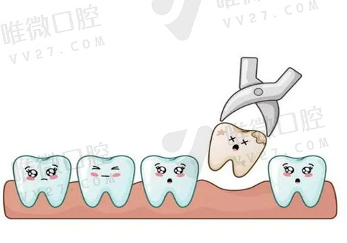 大众口腔医院其他项目价格