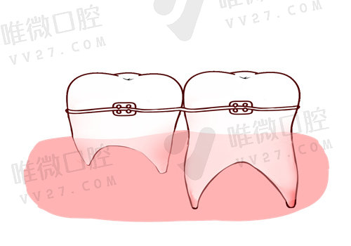 深圳麦芽口腔金属矫正牙齿怎么样