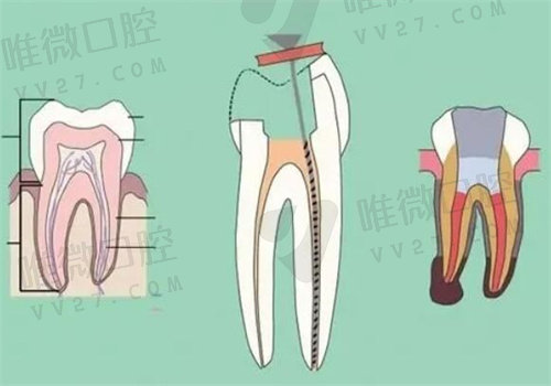 英博口腔医院牙齿矫正价格表