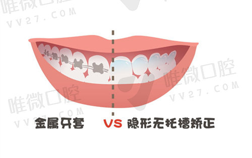 长沙牙齿矫正收费标准