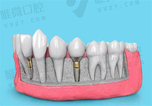 微笑口腔医院有几家分院