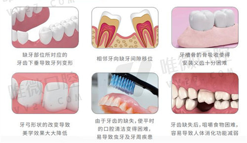 西安中诺口腔医院做韩国种植牙怎么样