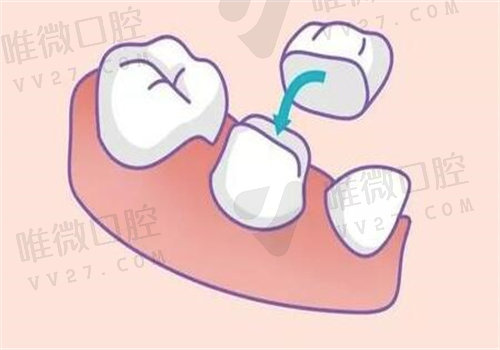 湛江市珠江口腔医院价格表