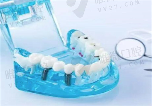 瑞泰口腔凭什么这么火