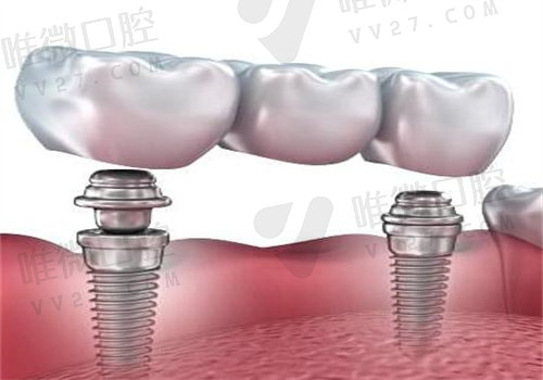 瑞泰口腔怎么样