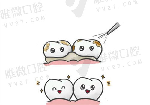 美奥口腔价格表
