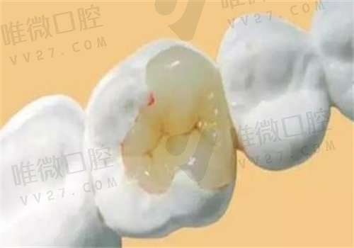 美呀植牙口腔医院怎么样
