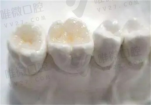 美呀植牙口腔医院怎么样