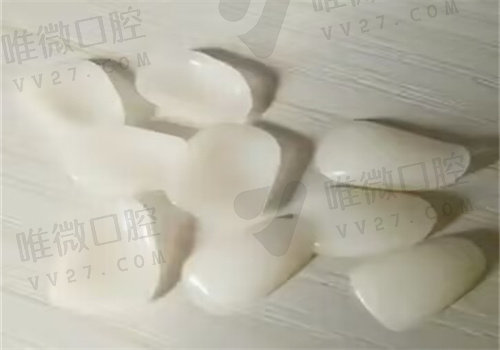 深圳善贝口腔门诊真人实例