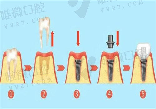 德 中口腔是正规的