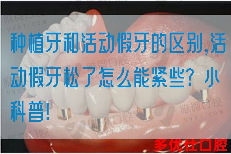 种植牙和活动假牙的区别,活动假牙松了怎么能紧些？小科普！(图1)