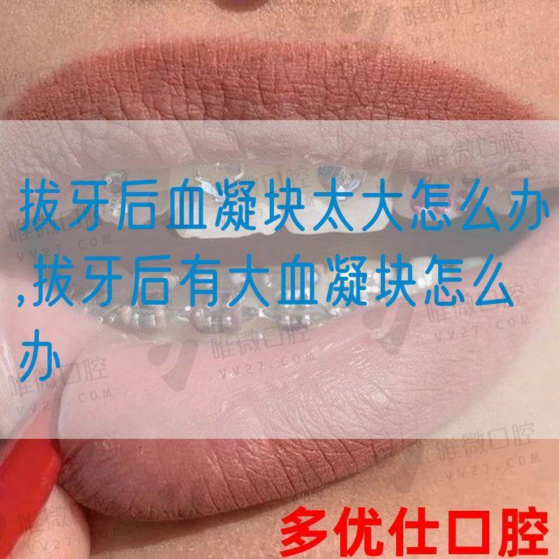拔牙后血凝块太大怎么办,拔牙后有大血凝块怎么办(图1)