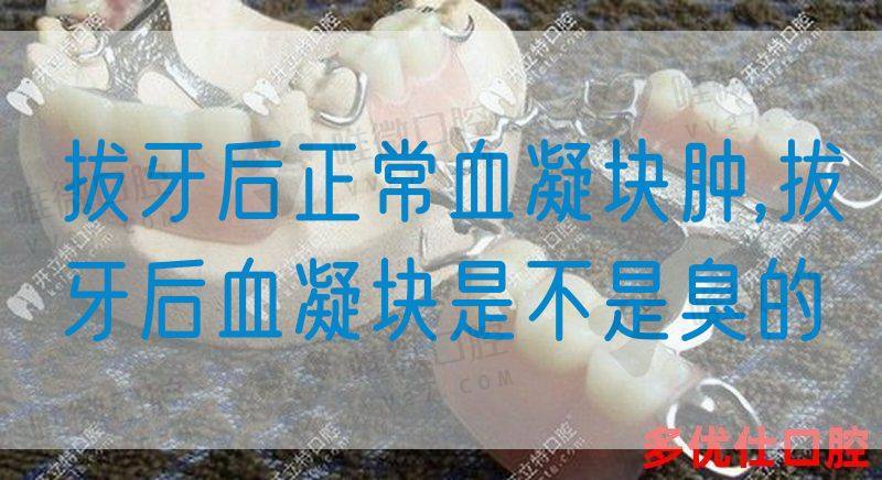 拔牙后正常血凝块肿,拔牙后血凝块是不是臭的(图1)