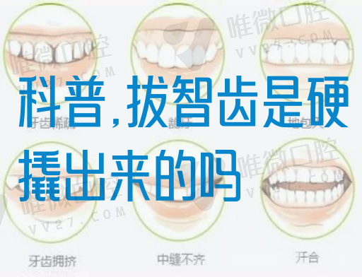 科普,拔智齿是硬撬出来的吗(图1)