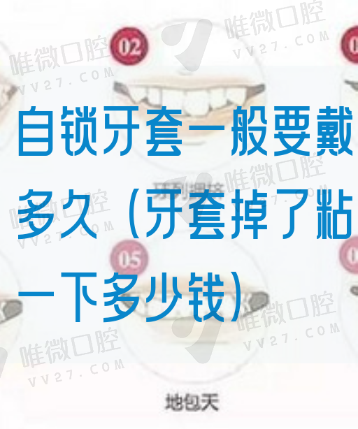 自锁牙套一般要戴多久（牙套掉了粘一下多少钱）(图1)