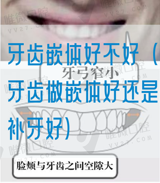 牙齿嵌体好不好（牙齿做嵌体好还是补牙好）(图1)