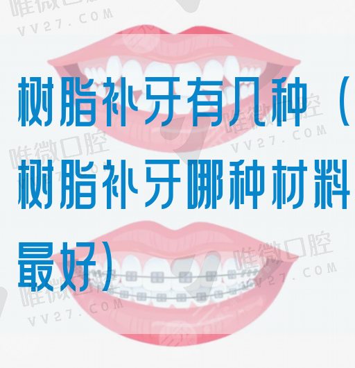树脂补牙有几种（树脂补牙哪种材料出色）(图1)