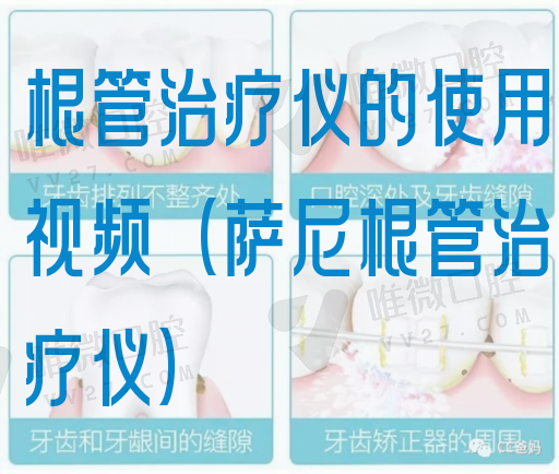 根管治疗仪的使用视频（萨尼根管治疗仪）(图1)