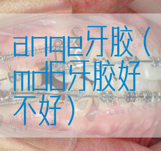 ange牙胶（mdb牙胶好不好）(图1)