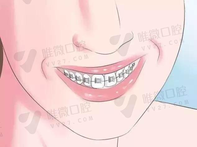 长春朝阳区超龙牙博士口腔门诊部：牙齿内倾斜矫正项目费用是多少？